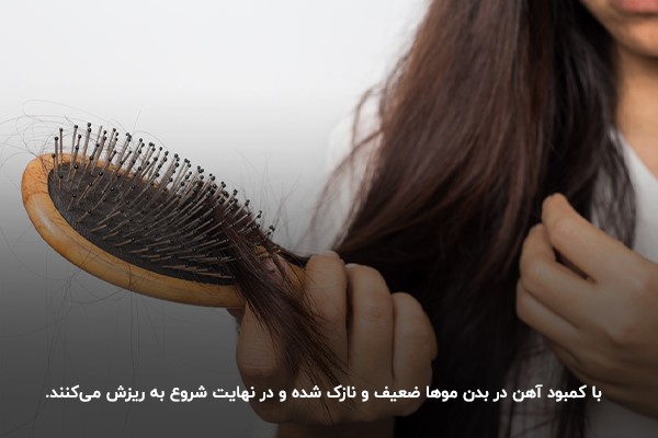 ریزش مو؛ یکی از شایع‌ترین تاثیرات کم خونی در بزرگسالان 