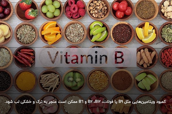 کمبود ویتامین گروه B؛ مهم‌ترین دلیل خشکی لب در افراد گیاه‌خوار