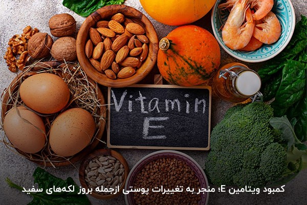 ویتامین E؛ خاصیت آنتی‌اکسیدانی و کمک به حفاظت پوست
