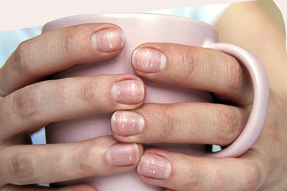 بررسی پاسخ سوال «لکه سفید روی ناخن کمبود چه ویتامینی است» در بلاگ نیچرز